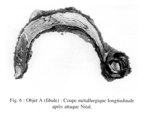 Coupe de la fibule